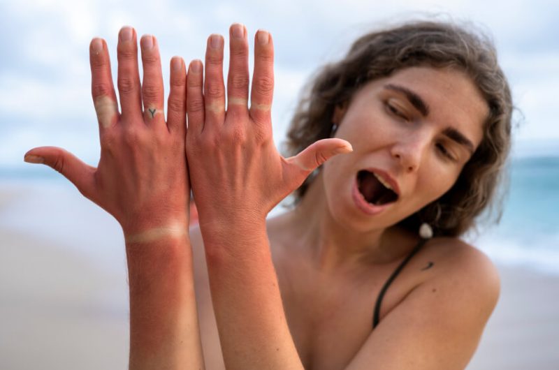 Cilt Lekeleri Neden Oluşur? Etkili Tedavi Seçenekleri